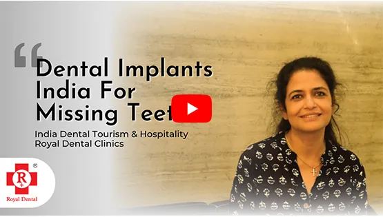 Dental Implants India for Missing Teeth