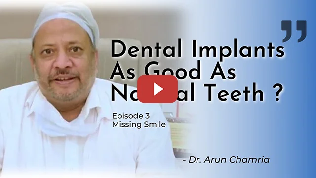 Dental Implant Just Like Natural Teeth