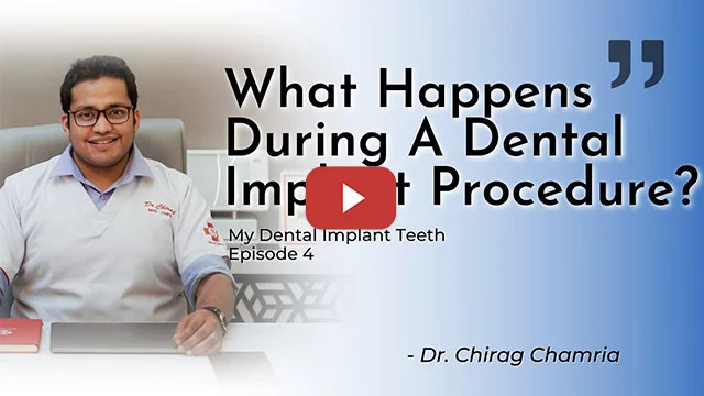 Dental Implantologist in Mumbai